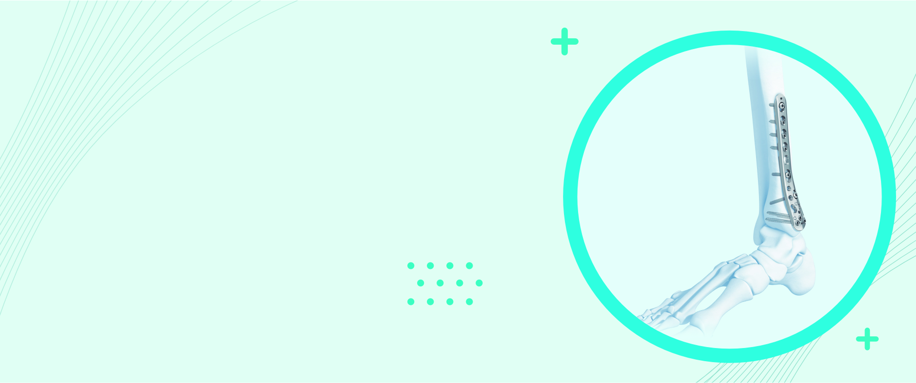 Precision Engineering for a Stronger Tomorrow Advanced orthopedic implants designed to restore mobility, improve outcomes, and empower patient recovery.